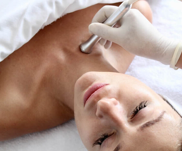 Oxylight Diamond Microdermabrasion